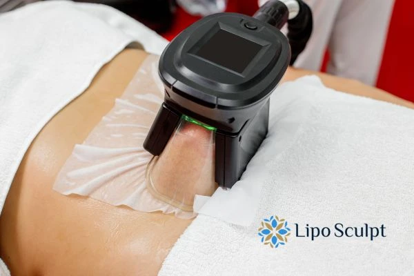 Does Fat Freezing at Home Work? DIY Devices vs Professional Cryolipolysis 1 How is professional cryolipolysis different Stotfold?